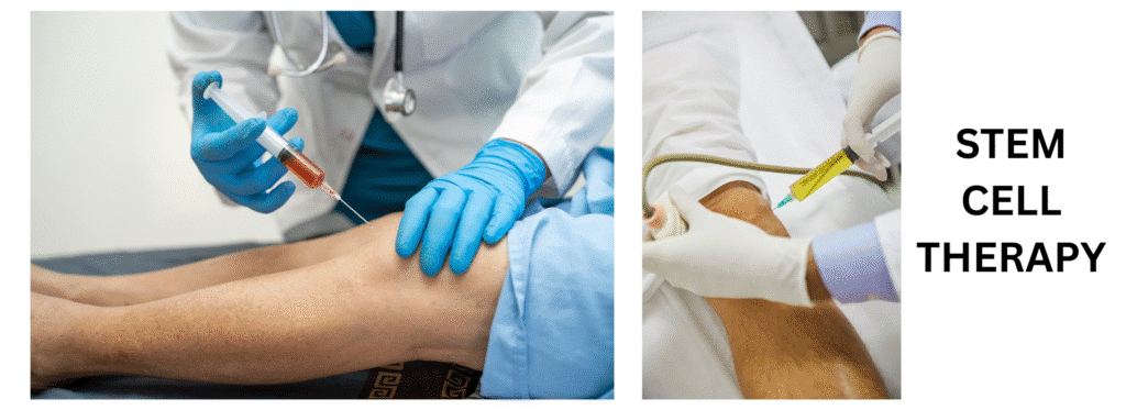 best place to get stem cell treatment
