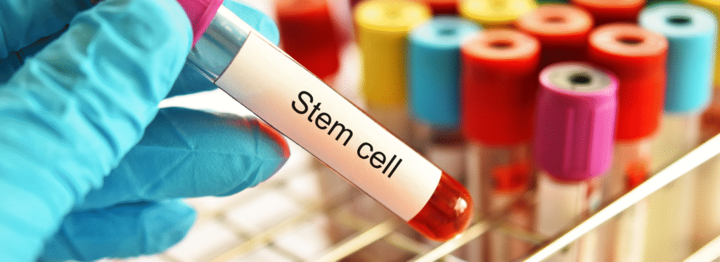 best stem cell therapy in India